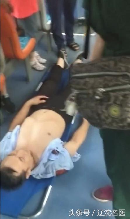 动脉血管瘤引起的蛛网膜下腔出血,动脉血管瘤压迫神经