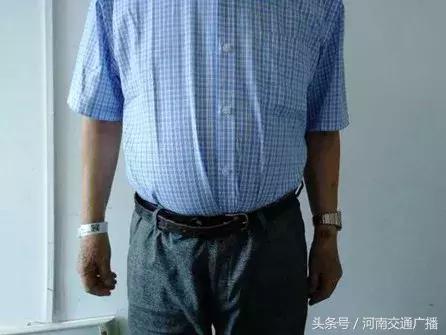 天呐！大爷吃掉上百支“皮炎平”软膏，医生一问都懵了