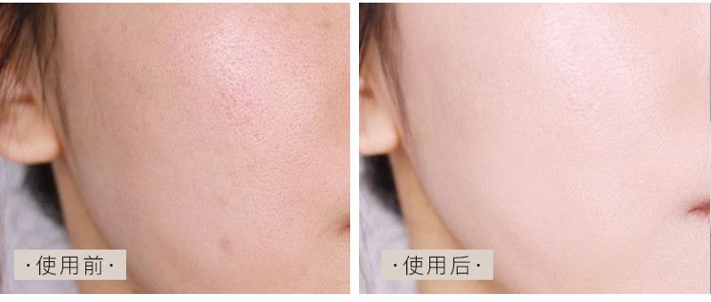 洗脸敷面膜也很好用,洗脸敷面膜护肤