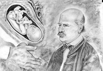 外科手术起源的血腥历史,外科手术历史故事