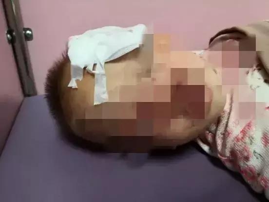 小孩被狗当街撕咬自家狗保护,女婴遭狗扑咬完整视频