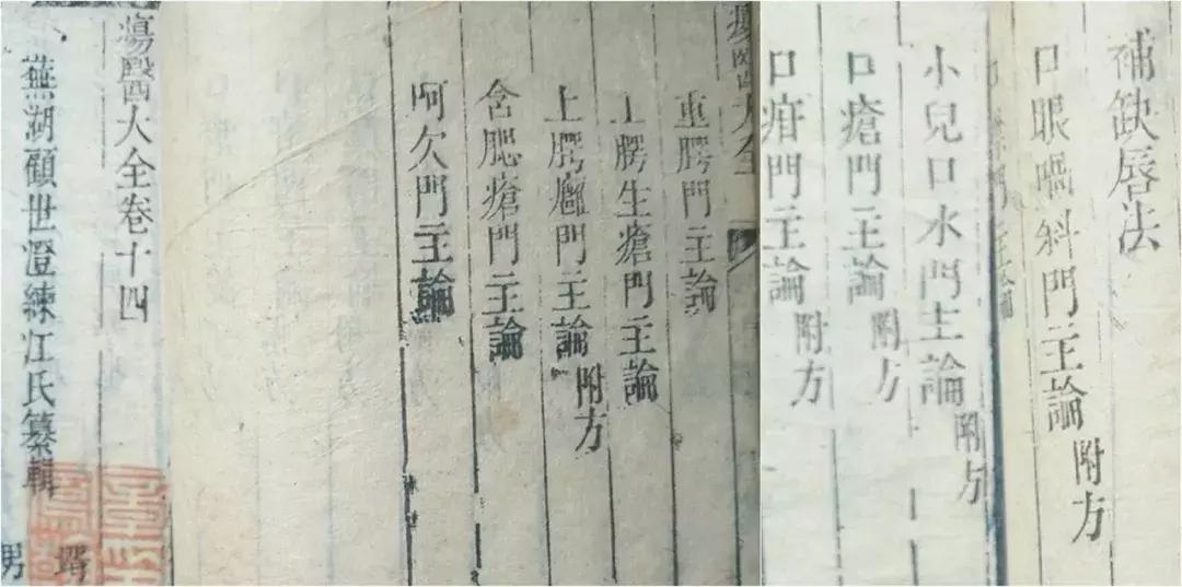 现代易容术整容技术,易容术复原面部缺陷