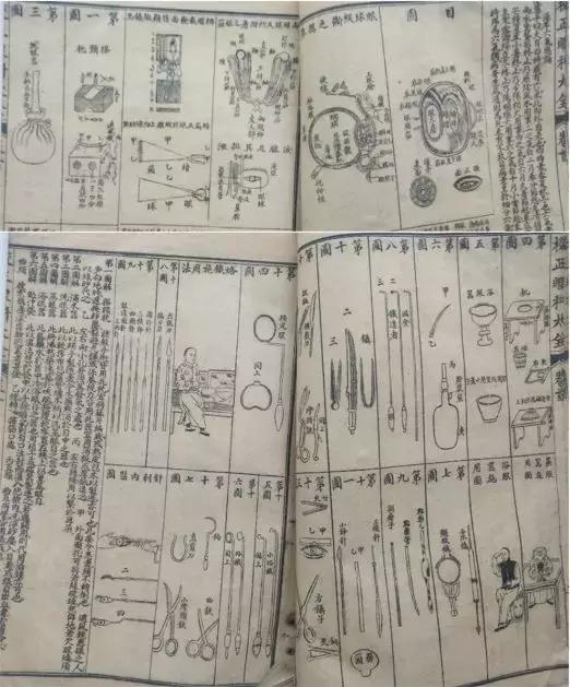 现代易容术整容技术,易容术复原面部缺陷