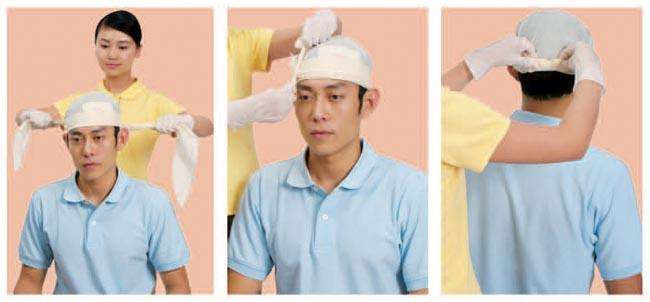 头部轻微外伤怎么处理,儿童头部外伤处理