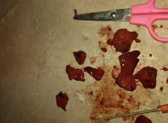 夜钓黄蜂鱼和土鲶一大盆,被鱼鳍割破了手