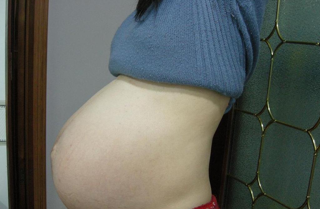 什么原因会导致胎儿入盆,促进胎儿入盆的最佳方法