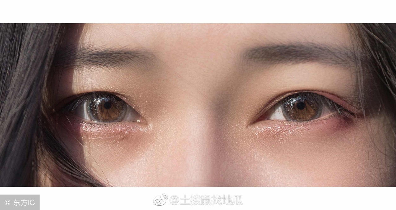 两只眼睛上眼皮浮肿是什么原因,每天睡起来眼睛浮肿是什么原因