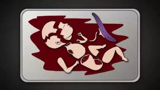 流产中的胎儿会有痛苦感受吗？流产后的他们又都去了哪里？