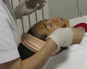 微针值得做吗,口碑最好的微针