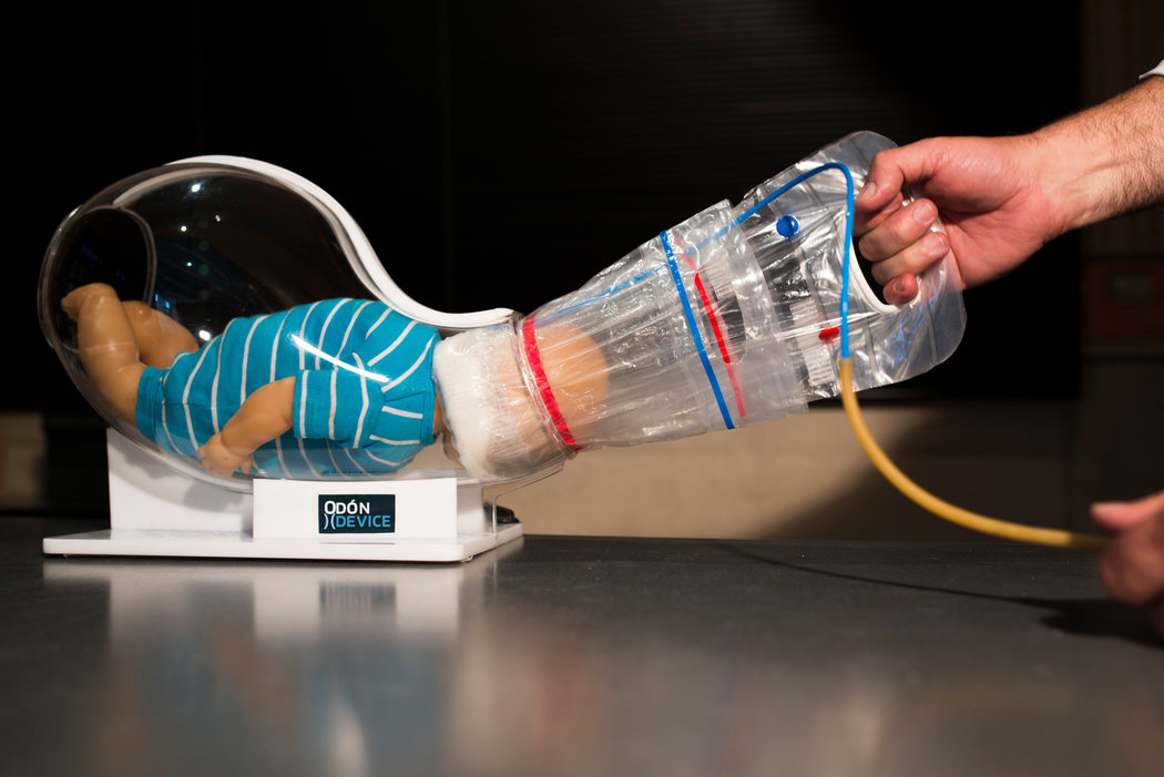 葡萄酒瓶里的软木塞给他灵感,汽车修理工发明出了生孩子的工具