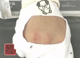 各类驱蚊产品测试,驱蚊产品测试100只蚊子