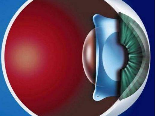 近视怎么改善眼力,近视了还能提高裸眼视力吗