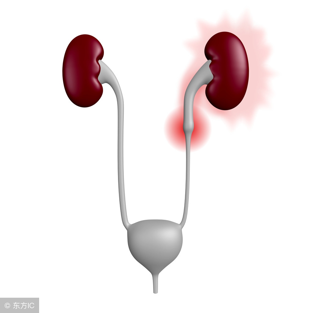 尿结石会不痛不痒尿血吗,尿结石不痛但没下来