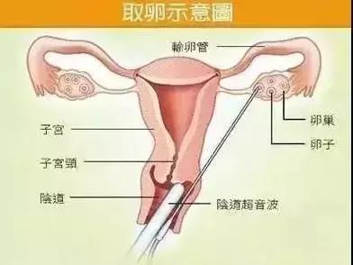 大学生买卵对身体的危害,女性卖卵的危害