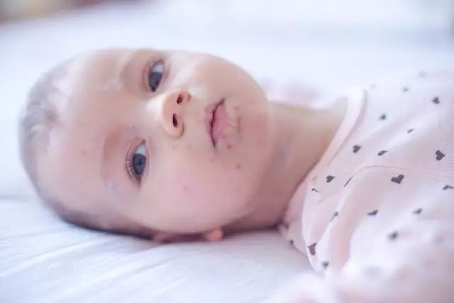 螨虫走开！中疾控检测100%有效，家有小宝、消除过敏源必备