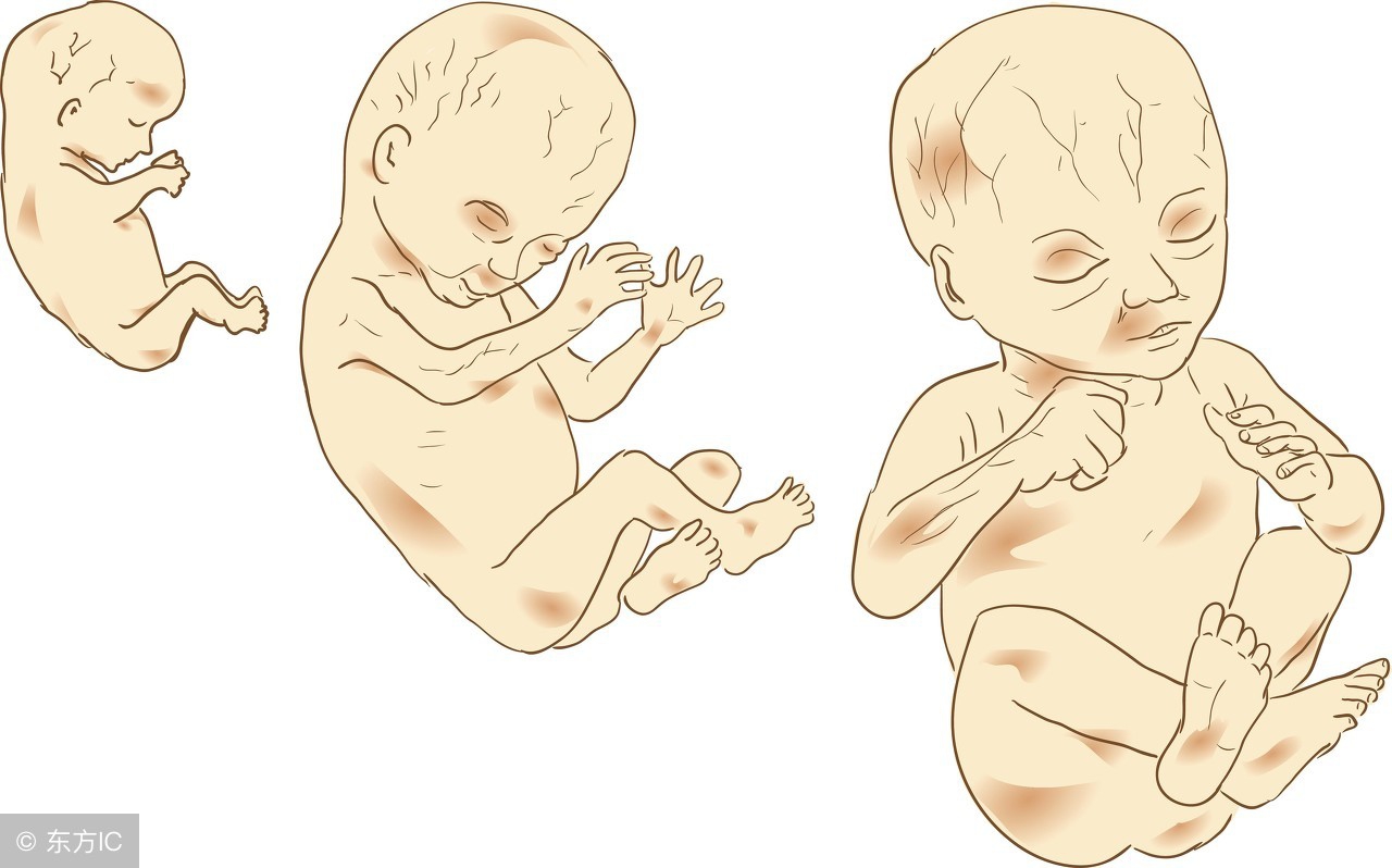 胎儿入盆早需要注意些什么,促进胎儿入盆有什么办法