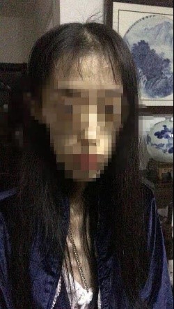 21岁女孩瘦50斤变成植物人,21岁的女孩减肥暴瘦五十七斤