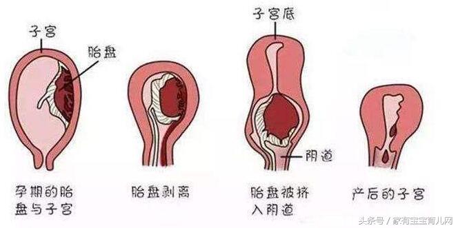 产后42天子宫复旧不良一直出血,产后九个月子宫复旧不良
