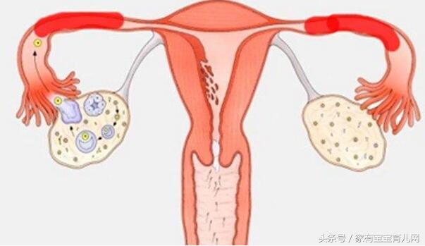 产后42天子宫复旧不良一直出血,产后九个月子宫复旧不良