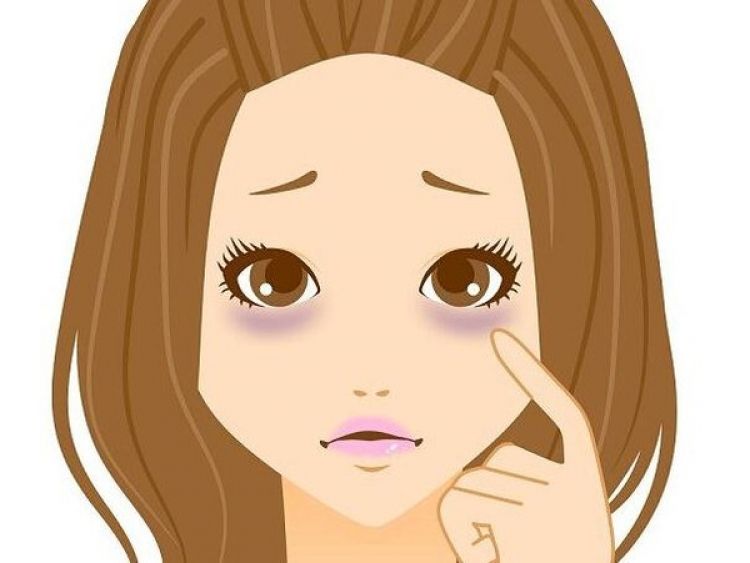 眼袋可以改善成卧蚕吗,祛除眼袋手术会把卧蚕去掉吗