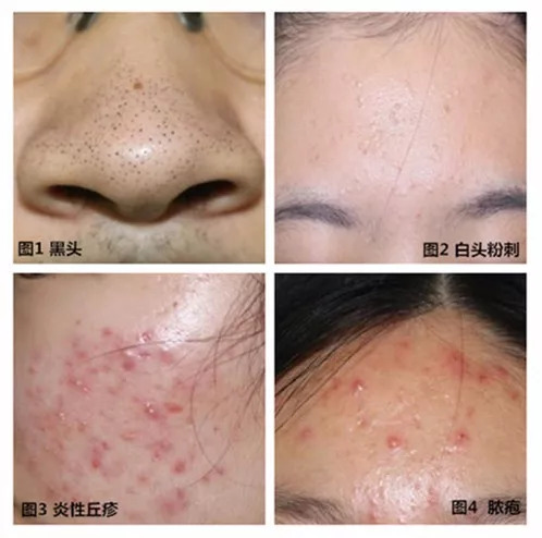 空总就医陪诊,空军总医院义诊