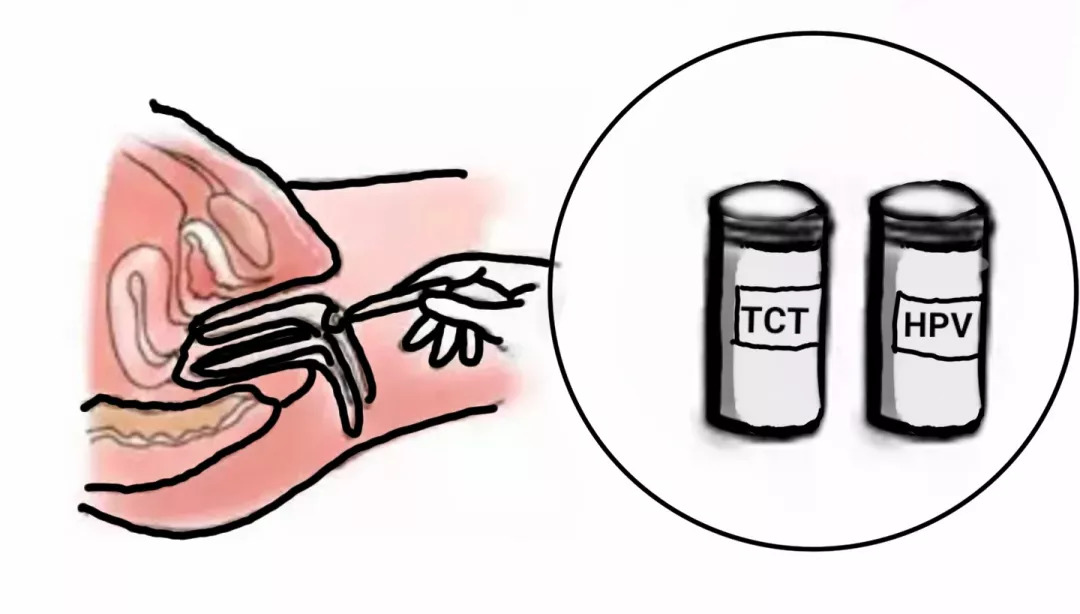 女性宫颈糜烂是什么原因引起的,女性宫颈糜烂有什么症状和现象