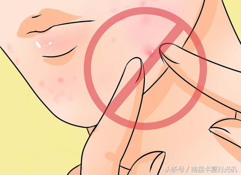 痘痘彻底好了怎么成为不长痘体质,怎样做才能使痘痘不再反反复复