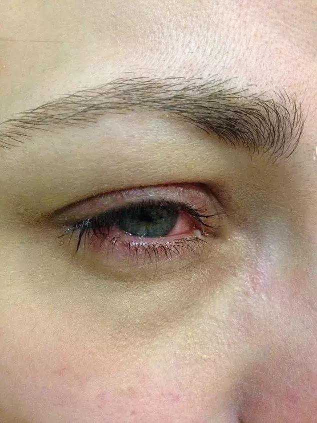 10鍏冨乏鍙崇殑moc,10鍏冪殑moc