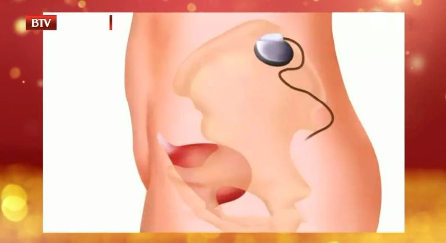 膀胱有问题,这些疾病都会找上门!忽视“漏尿”,当心拖成尿毒症