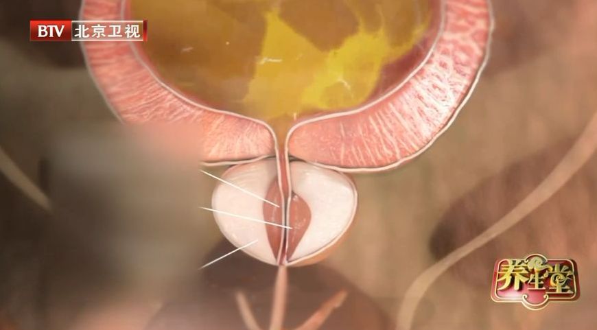 膀胱有问题,这些疾病都会找上门!忽视“漏尿”,当心拖成尿毒症