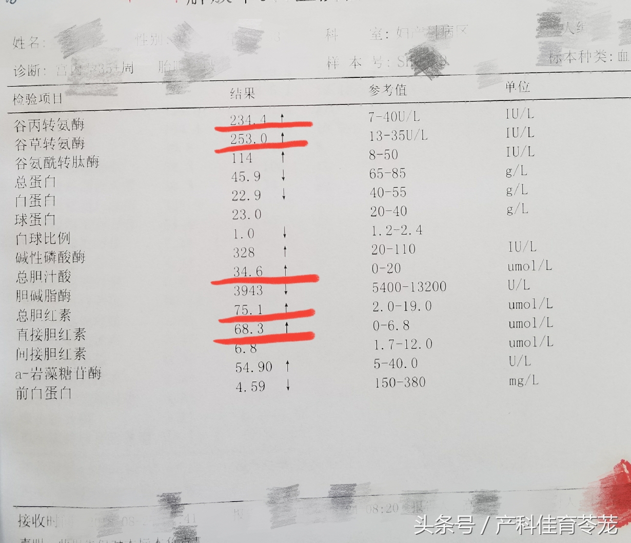 妊娠期总胆汁酸高说明什么影响,妊娠期肝内胆汁酸增高