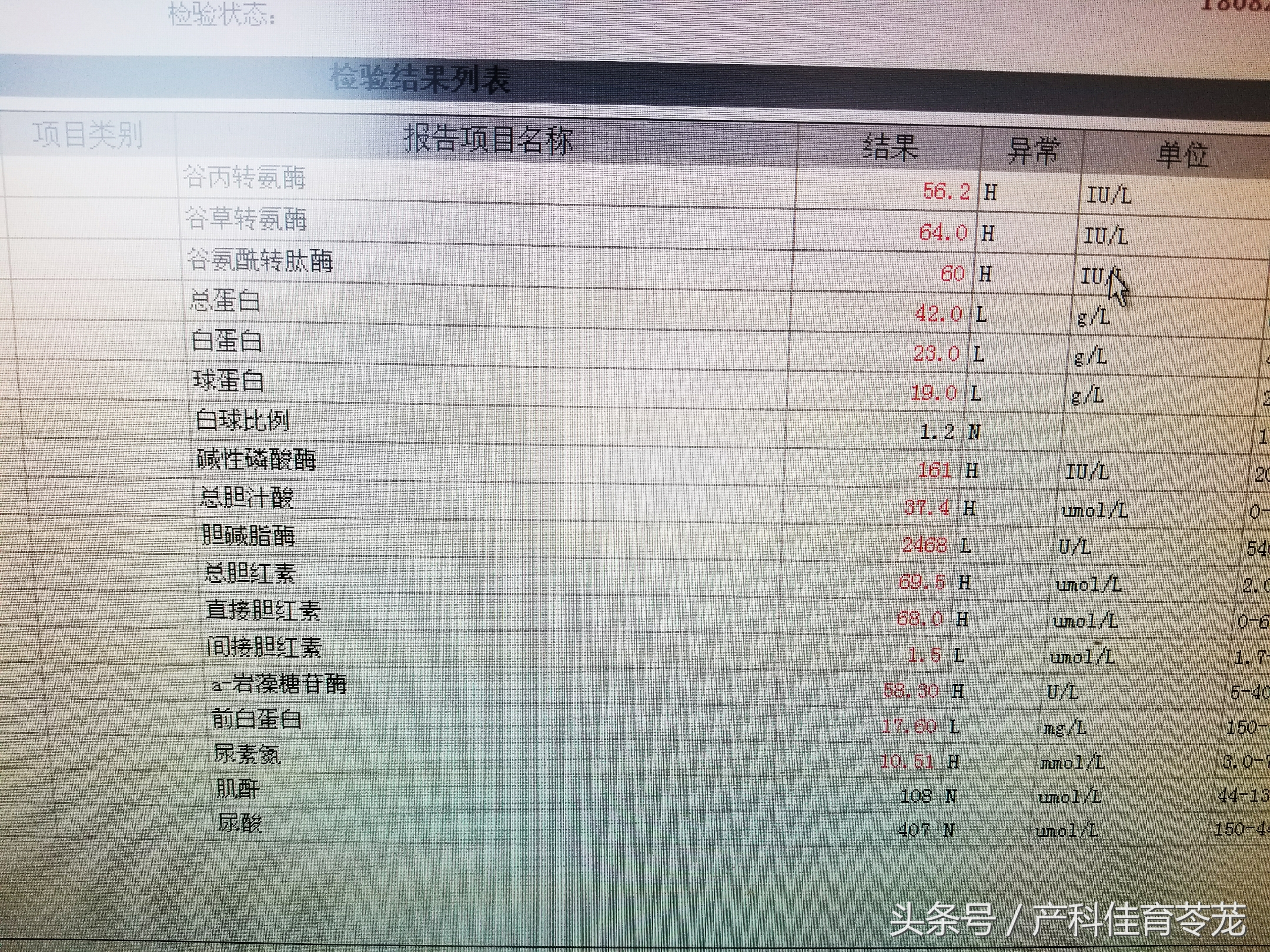 妊娠期总胆汁酸高说明什么影响,妊娠期肝内胆汁酸增高