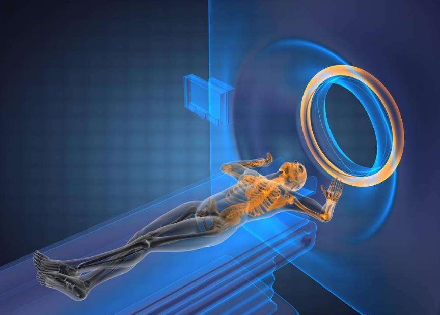 核磁共振ai技术,ai智能核磁共振