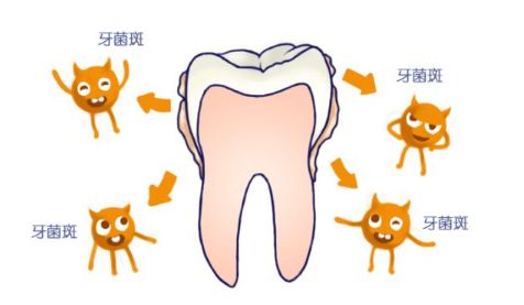 没刷牙的时候牙龈出血是什么原因,早上起来刷牙牙龈出血恶心干呕