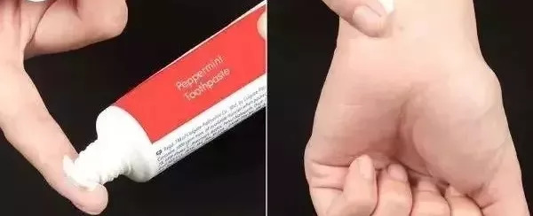 蚊子咬完红肿硬很大怎么样能止痒,被蚊子咬到眼睛最快消肿止痒妙招