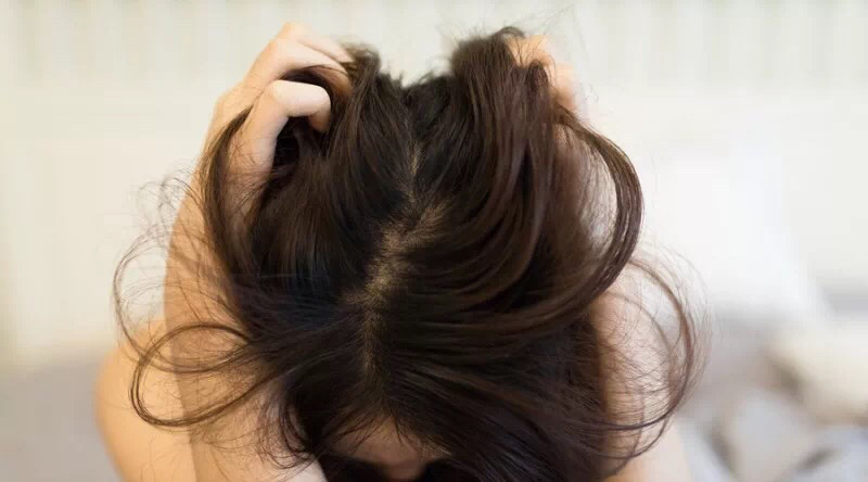 理发师不会告诉你的“头皮养护法则”都在这里了！