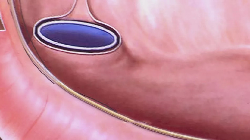 出现这些症状要警惕心脏问题,警惕心脏有问题的3个信号