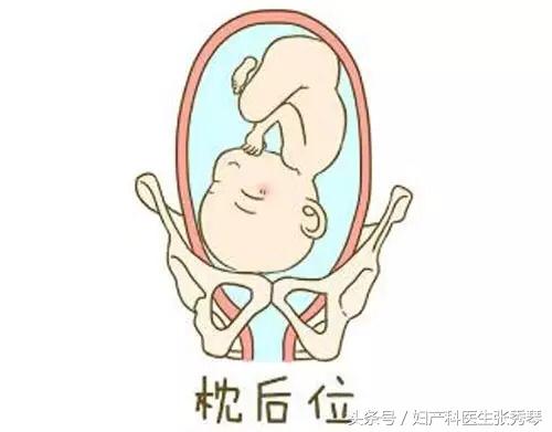 孕晚期时出现胎位不正要怎么应对,孕晚期胎位不正的常见原因