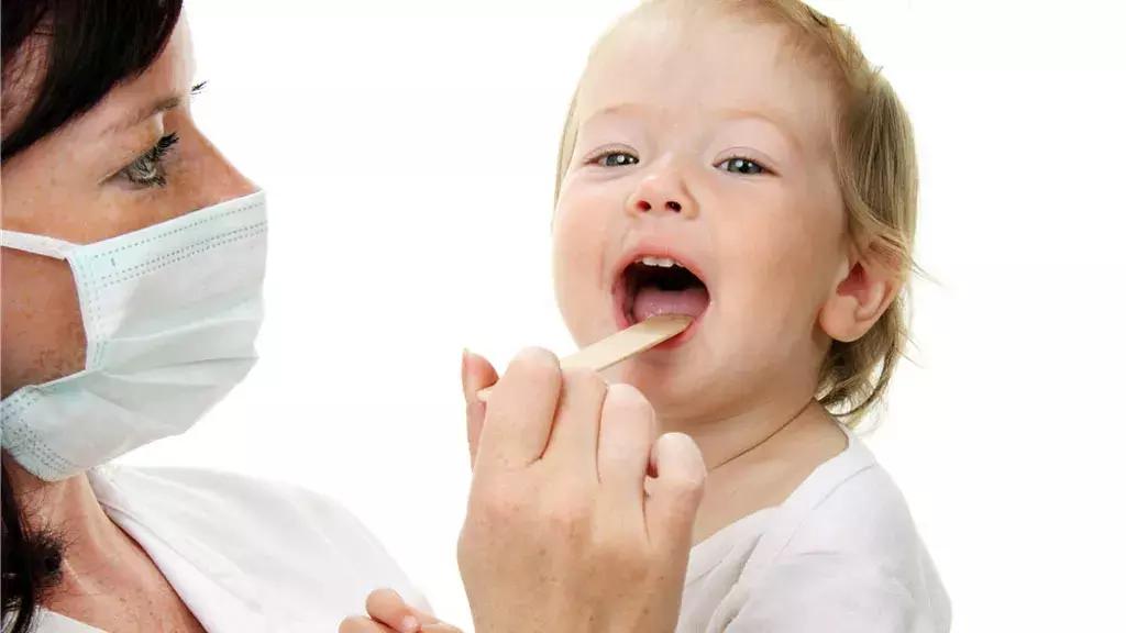 宝宝嘴角两边起干皮怎么办,嘴角边脱皮怎么回事