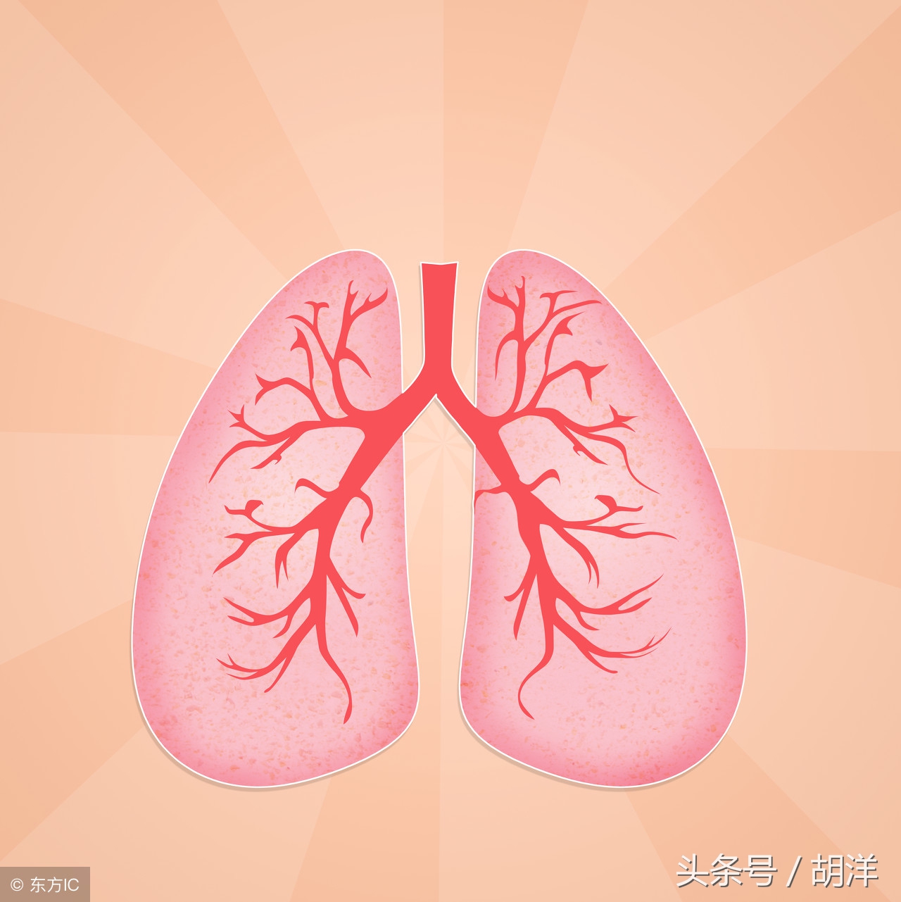 肺癌诊断恶性会有咳血可能吗,肺癌早期咳血治不好严重吗