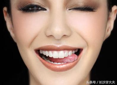 怎么让大黄牙快速变白,30天解决大黄牙