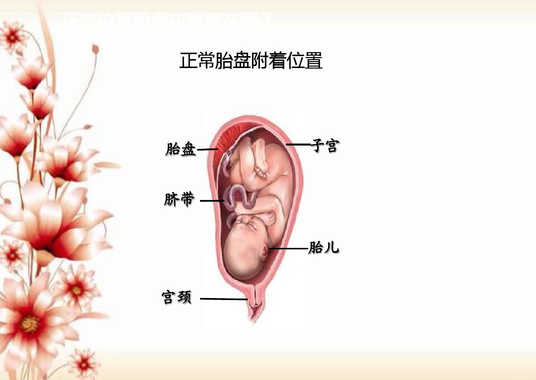 前置胎盘下怀的宝妈,前置胎盘的孕妈