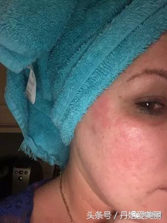 10鍏冪殑moc,10鍏冨乏鍙崇殑moc