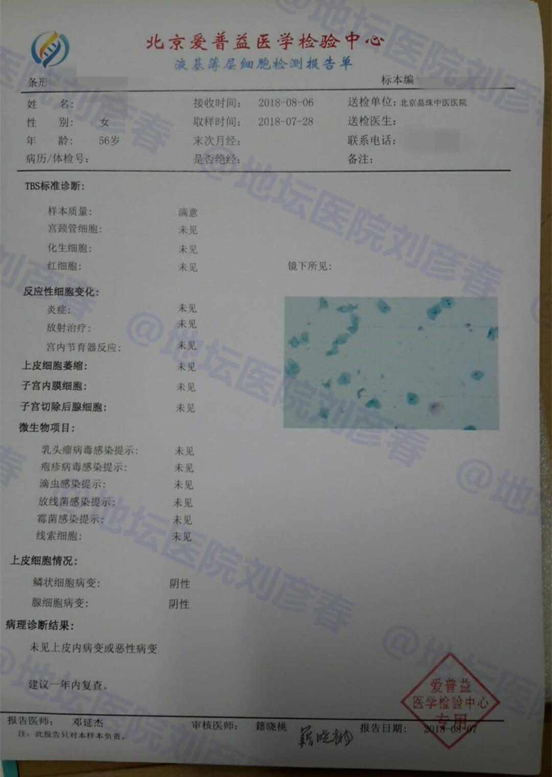 宫颈锥切后还有低级别病变,宫颈低度病变做了锥切会复发吗