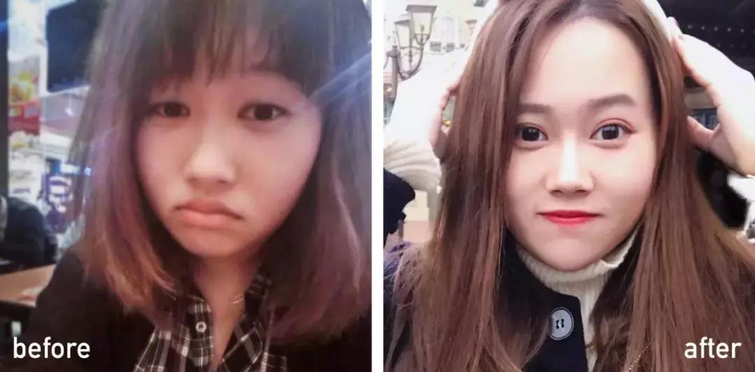 60岁整容亲身经历,整容亲身经历真的好吗