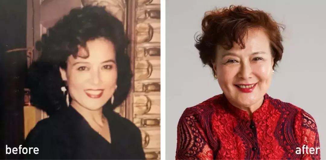 60岁整容亲身经历,整容亲身经历真的好吗