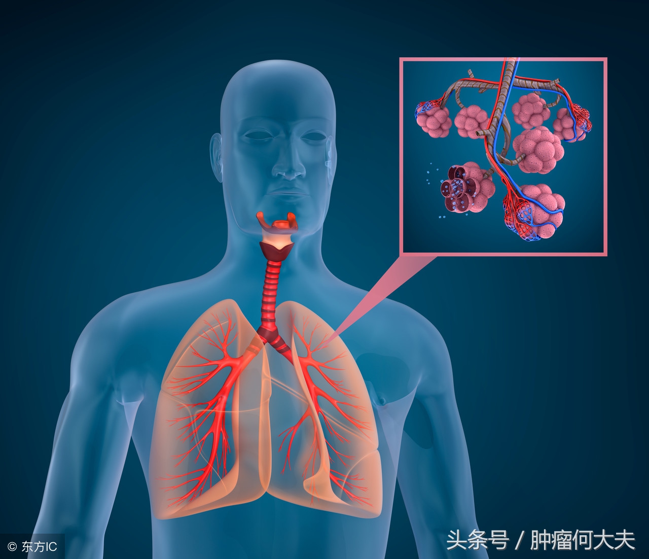 “X刀”、“Y刀”等肺癌治疗手段,其实是一种新型放疗技术