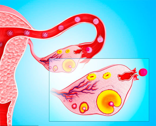 卵巢年轻的女人，来月经时会有4个习惯，你若有2个以上，那也很好