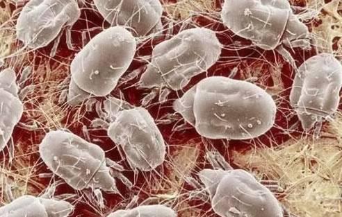 脸上祛螨虫小妙招,脸上最近半年有好多螨虫