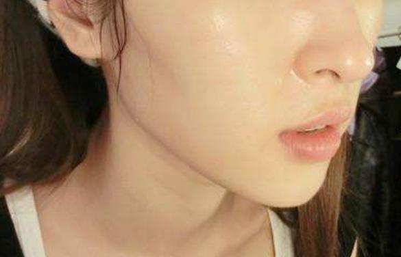 脸上祛螨虫小妙招,脸上最近半年有好多螨虫